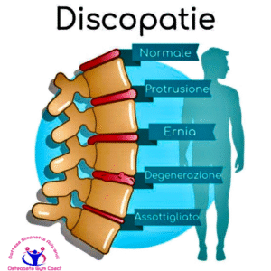 Discopatie Degenerative